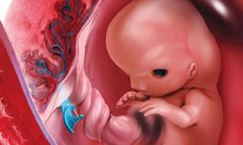 غربالگري ناهنجاري‌هاي شايع كروموزومي با رويكرد Contingent در غربالگري سه ماهه اول بارداري با استفاده از NT, DV,NIPT